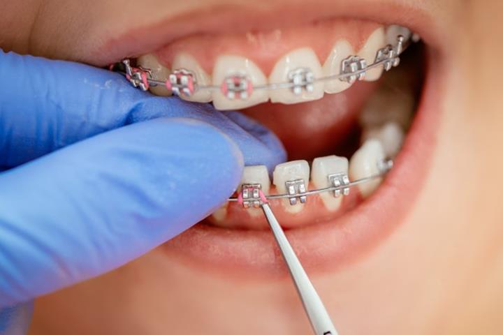 تاثیر تکنولوژی بر انجام ارتودنسی دندان