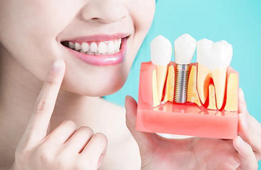 شرایط سنی  انجام  ایمپلنت دندان