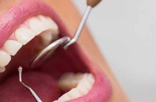 روش منتخب کامپوزیت دندان