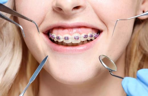 ارتودنسی دندان مرحله به مرحله