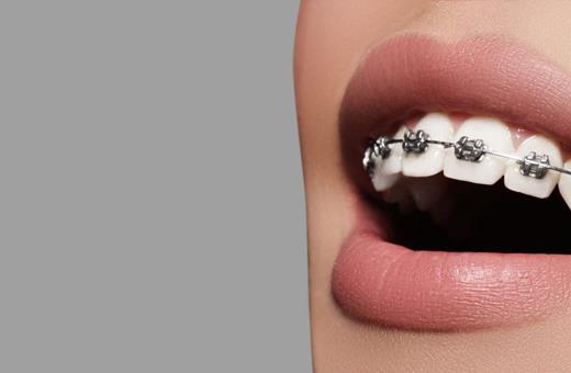 بی حسی در ارتودنسی دندان   