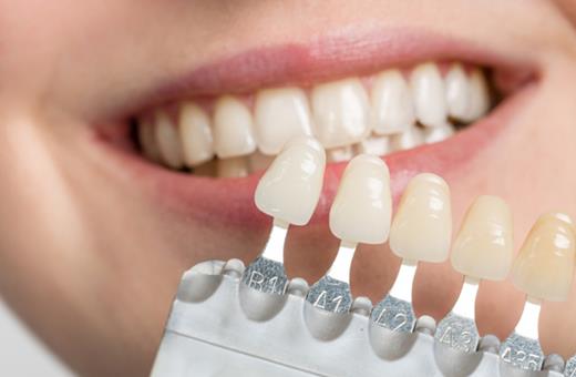 کامپوزیت دندان روش جایگزینش وجود دارد؟