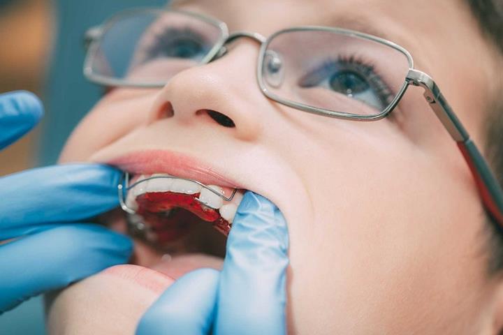 ارتودنسی دندان در اطفال