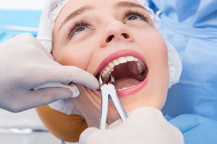 تجربه کشیدن دندان عقل
