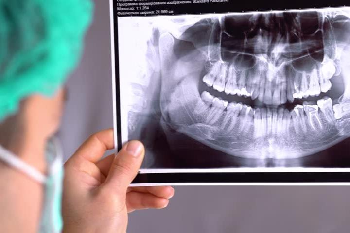رادیوگرافی دندان