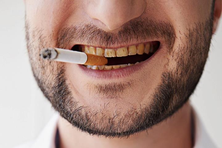  تاثیر سیگار بر دندان 
