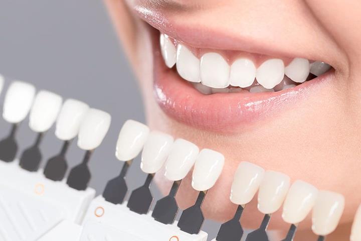 برای کامپوزیت دندان چه شرایطی لازم است؟