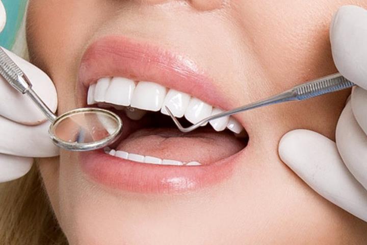 کامپوزیت دندان و نحوه نصب آن