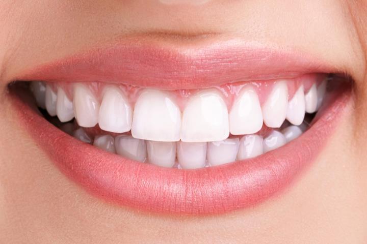 کامپوزیت دندان منع مصرف غذایی دارد؟