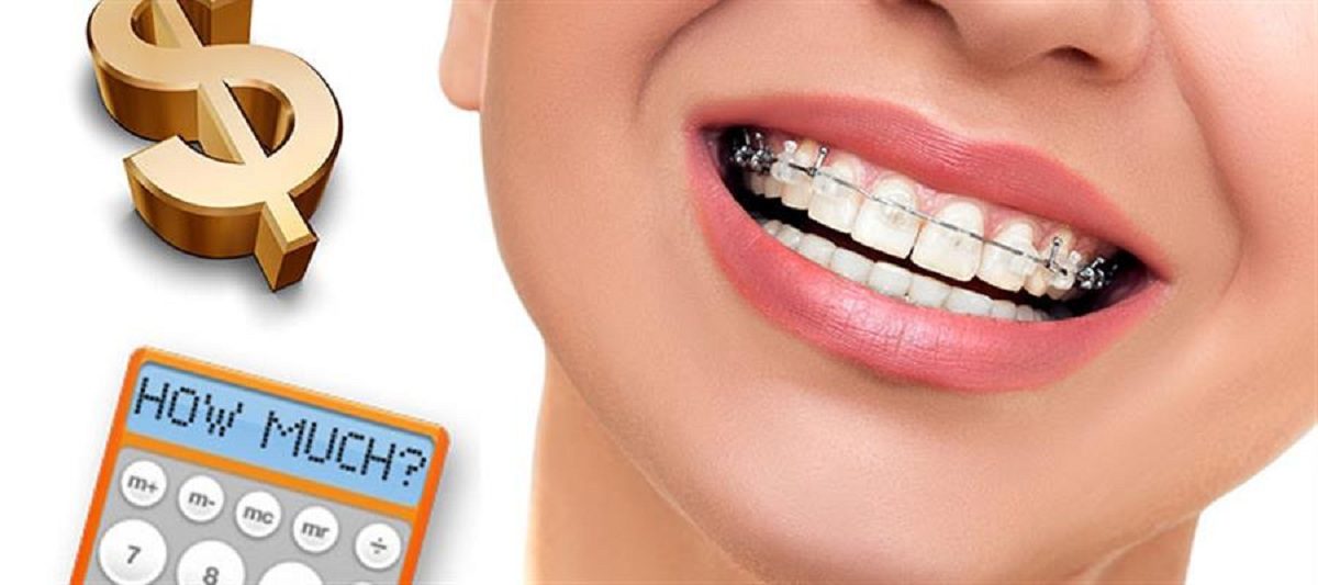 قیمت ارتودنسی 1401