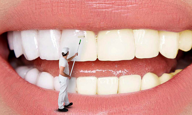 سفید کردن  کامپوزیت دندان