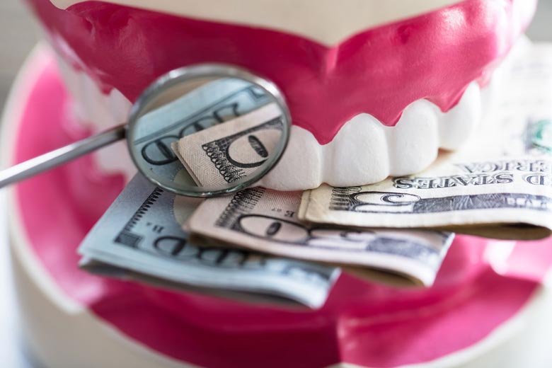 هزینه-کامپوزیت-دندان
