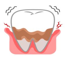 درمان-لمینت-دندان