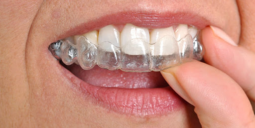 Dental-orthodontics