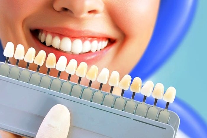 آیا کامپوزیت باعث جلوآمدن دندان میشود؟