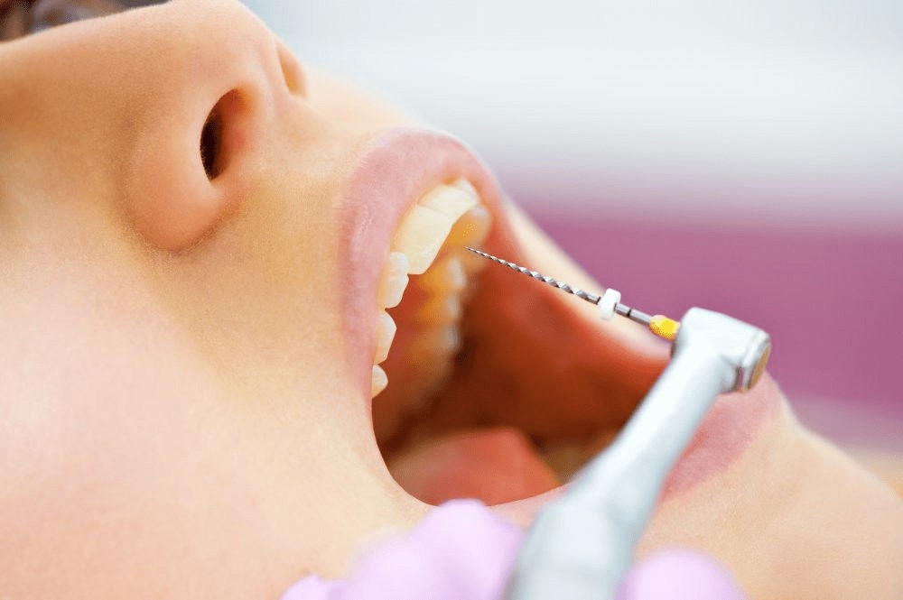 کلینیک تخصصی برای انجام درمان ریشه دندان