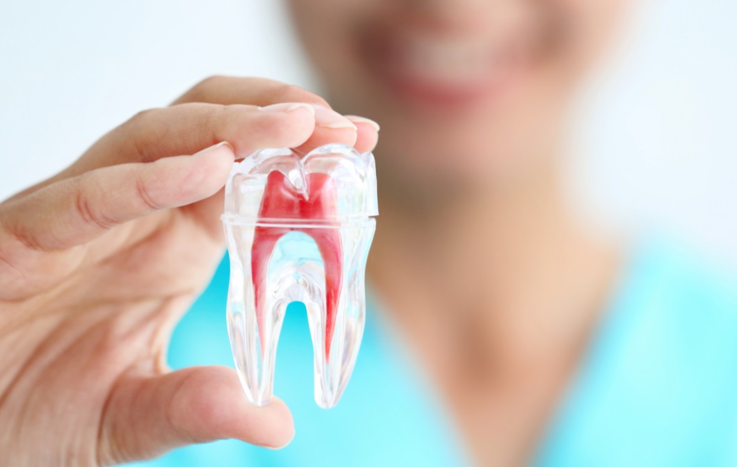 درمان ریشه دندان یا همان عصب کشی دندان چه زمانی واجب میشود؟ 