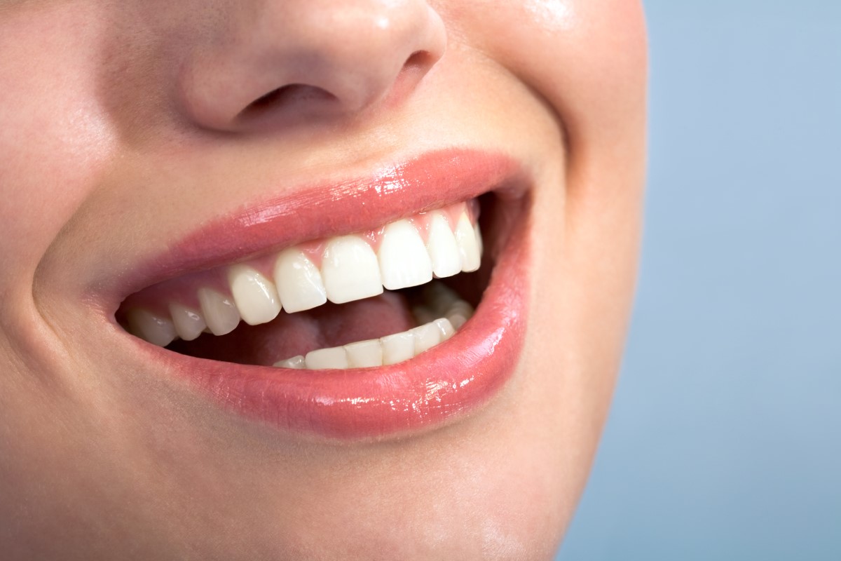 آیا کامپوزیت دندان از بین میرود؟
