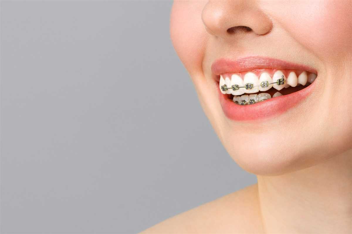 ابزار و موارد کاربردی در ارتودنسی دندان