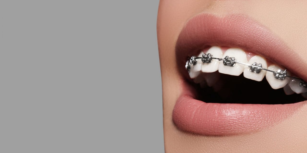 بی حسی در ارتودنسی دندان   