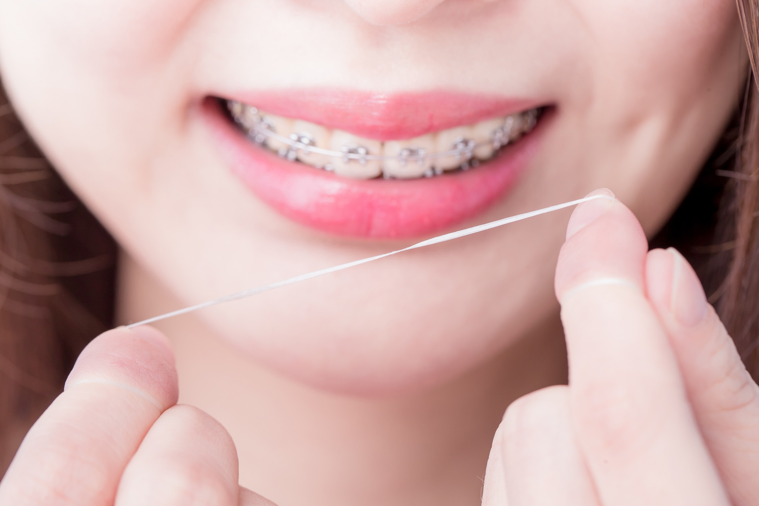 روش صحیح نخ دندان کشیدن برای ارتودنسی 