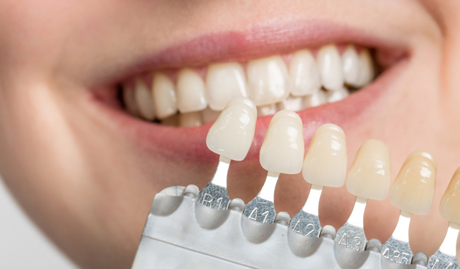 کامپوزیت دندان روش جایگزینش وجود دارد؟
