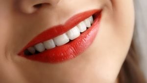 کیفیت کامپوزیت دندان