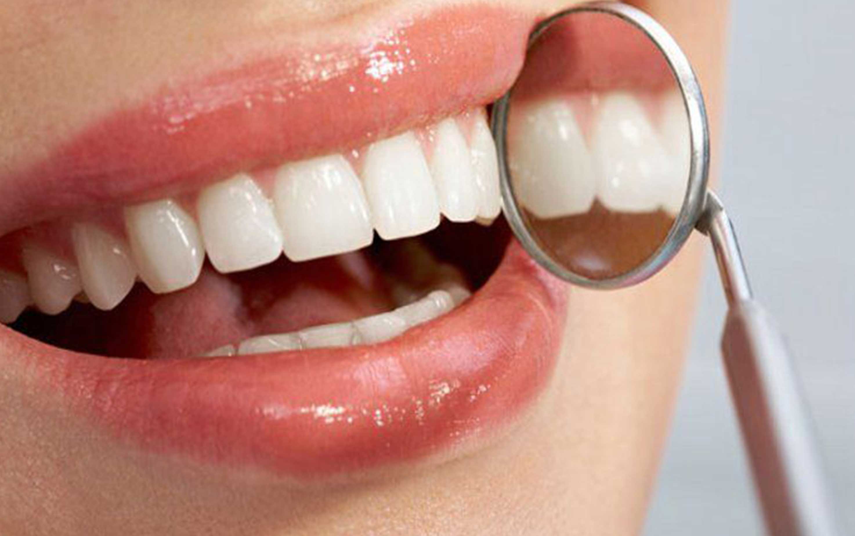 دلایل تغییر رنگ کامپوزیت دندان