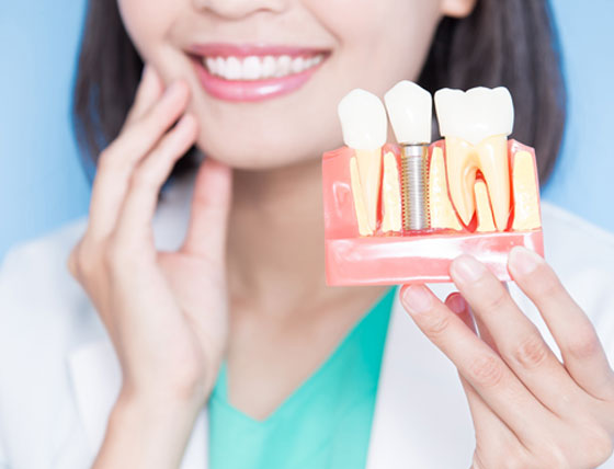 ایمپلنت دندان