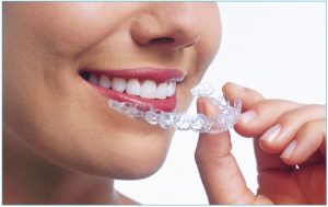 ارتودنسی دندان