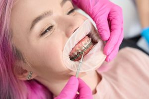 ارتودنسی دندان