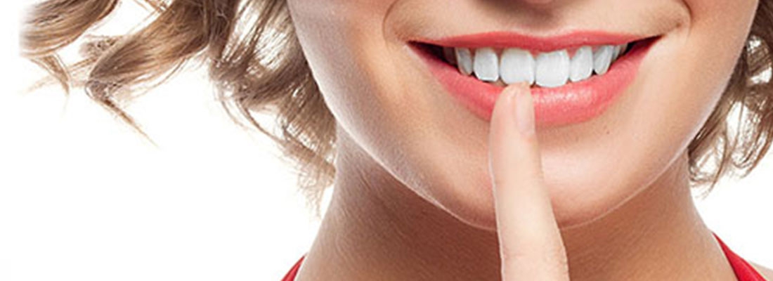 لمینت دندان