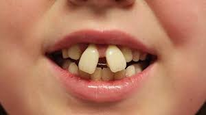 ارتودنسی دندان