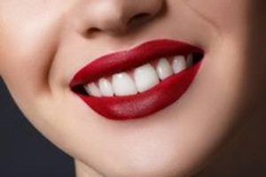 لمینت