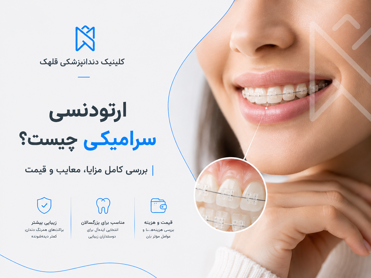 ارتودنسی سرامیکی