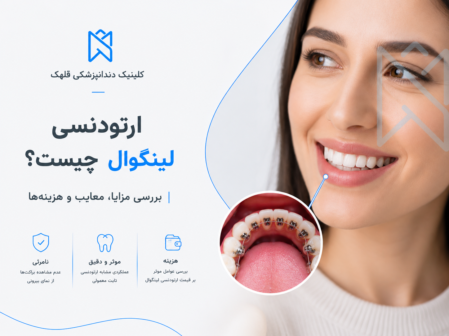 ارتودنسی لینگوال