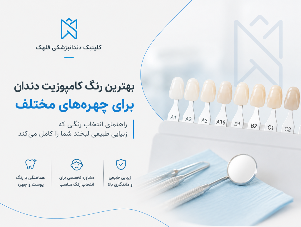 کامپوزیت دندان