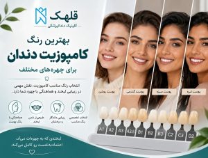 رنگبنذی کامپوزیت دندان