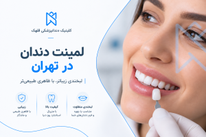 لمینت دندان